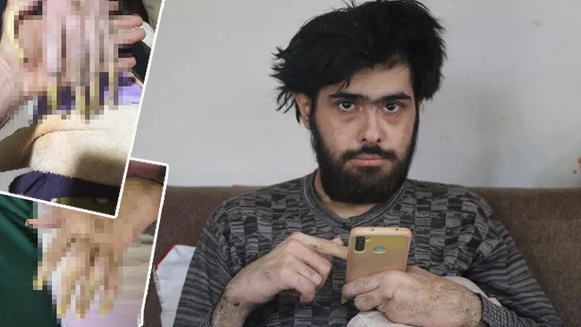 Depremin Yıkıcı İzleri Barış’ı Eve Hapsetti Annesi Çaresiz Yardım Bekliyor