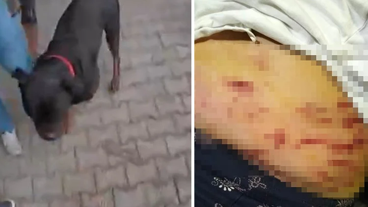 Mersin’de Ağızlıksız Gezdirilen Rottweiler İki Kişiyi Hastanelik Etti Sahibine Şikayet