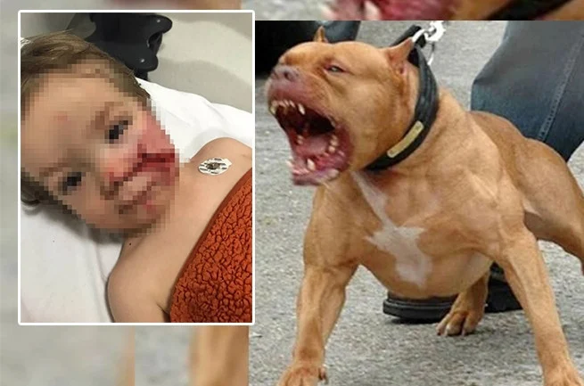 Ankara Etimesgut’ta Pitbull Saldırısı Sonucu 1 Buçuk Yaşındaki Çocuğun Yüzü Parçalandı