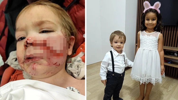 Ankara Etimesgut’ta Pitbull Saldırısına Uğrayan İki Kardeşin Dramı Komşu Gözaltına Alındı
