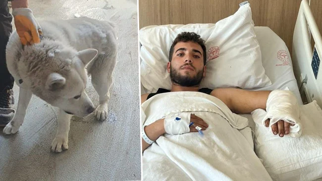Ankara’da İş Yerindeki Köpek Saldırısı Genç Adamı Ağır Yaraladı Ardından Hastanede Enfeksiyonla Mücadele Etti