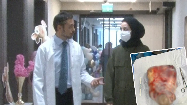 Karın Şişliğini Gaz Sanan Kadından 5 Kiloluk Dev Yumurtalık Kisti Alındı