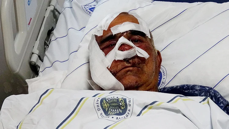 Doğubayazıt’ta Ayı Saldırısı Yaşlı Adamın Yüz Kemiklerini Kopardı Bölgede Beşinci Vaka