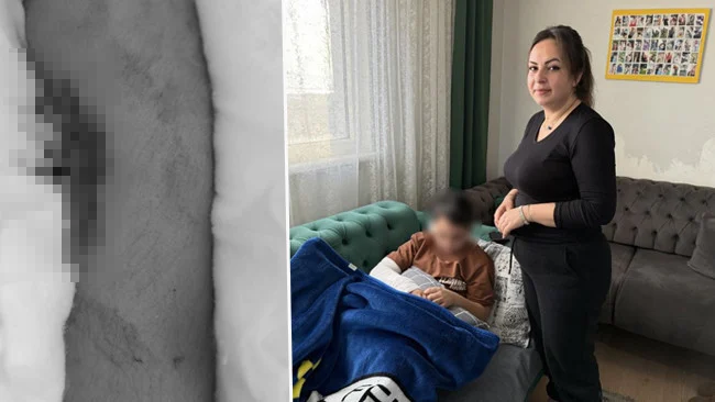 Büyükçekmece’de Akran Zorbalığı Dehşeti Sekiz Yaşındaki Çocuğun Kolunu İki Yerden Kırdı