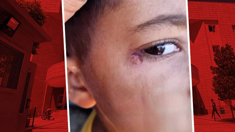 7 Yaşındaki Çocuğa Dehşet Temizlik Görevlisi Sigara Söndürüp Darbetti Tutuklandı