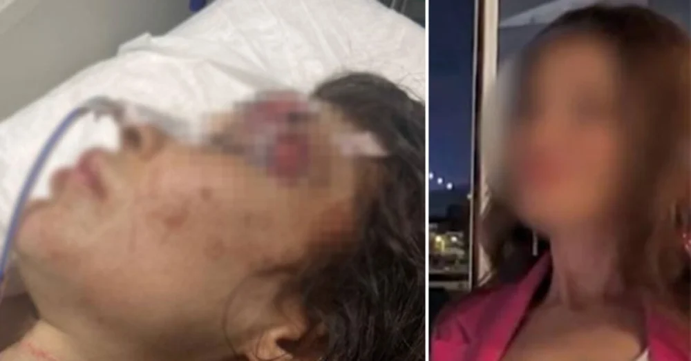 Boksör Furkan K’ya Sibel M’yi 20 Bıçak Darbesiyle Yaralama Suçlamasıyla 20 Yıla Kadar Hapis İstemi