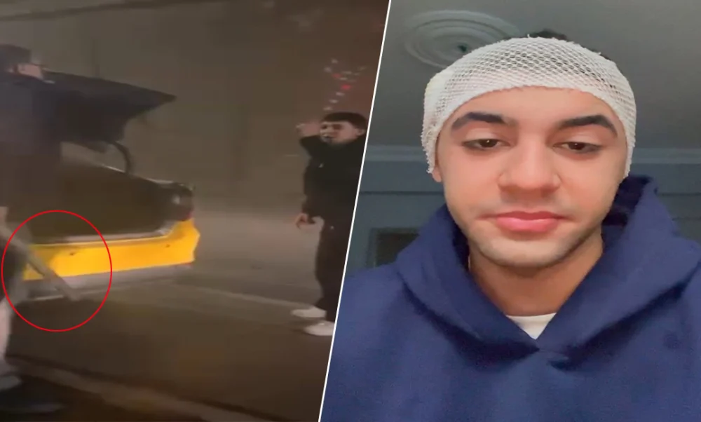 Kağıthane’de Trafik Tartışması Sopalı Saldırıya Dönüştü Motosiklet Sürücüsü Başından Yaralandı