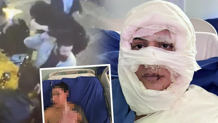 Kadıköy’deki Vahşi Saldırıda Alevler İçinde Kalan Genç Kadına Hastanede Tehdit Mesajları Geldi